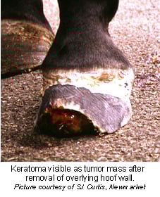 keratoma-1