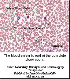 coombs_test-2