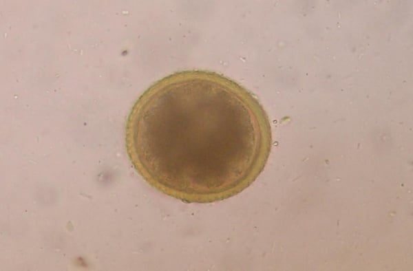 toxocara_canis_roundworm_egg_2 toxocara_canis_roundworm_egg_2