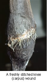 first_aid_wounds-1
