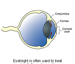 eyebright-2