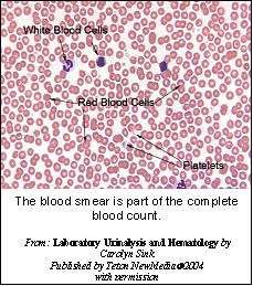 coombs_test-2