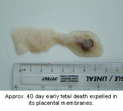 abortion-1