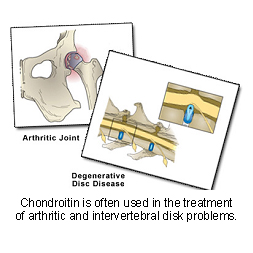 chondroitin-1