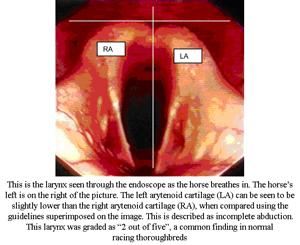 endoscopy-3
