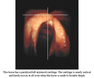 endoscopy-4