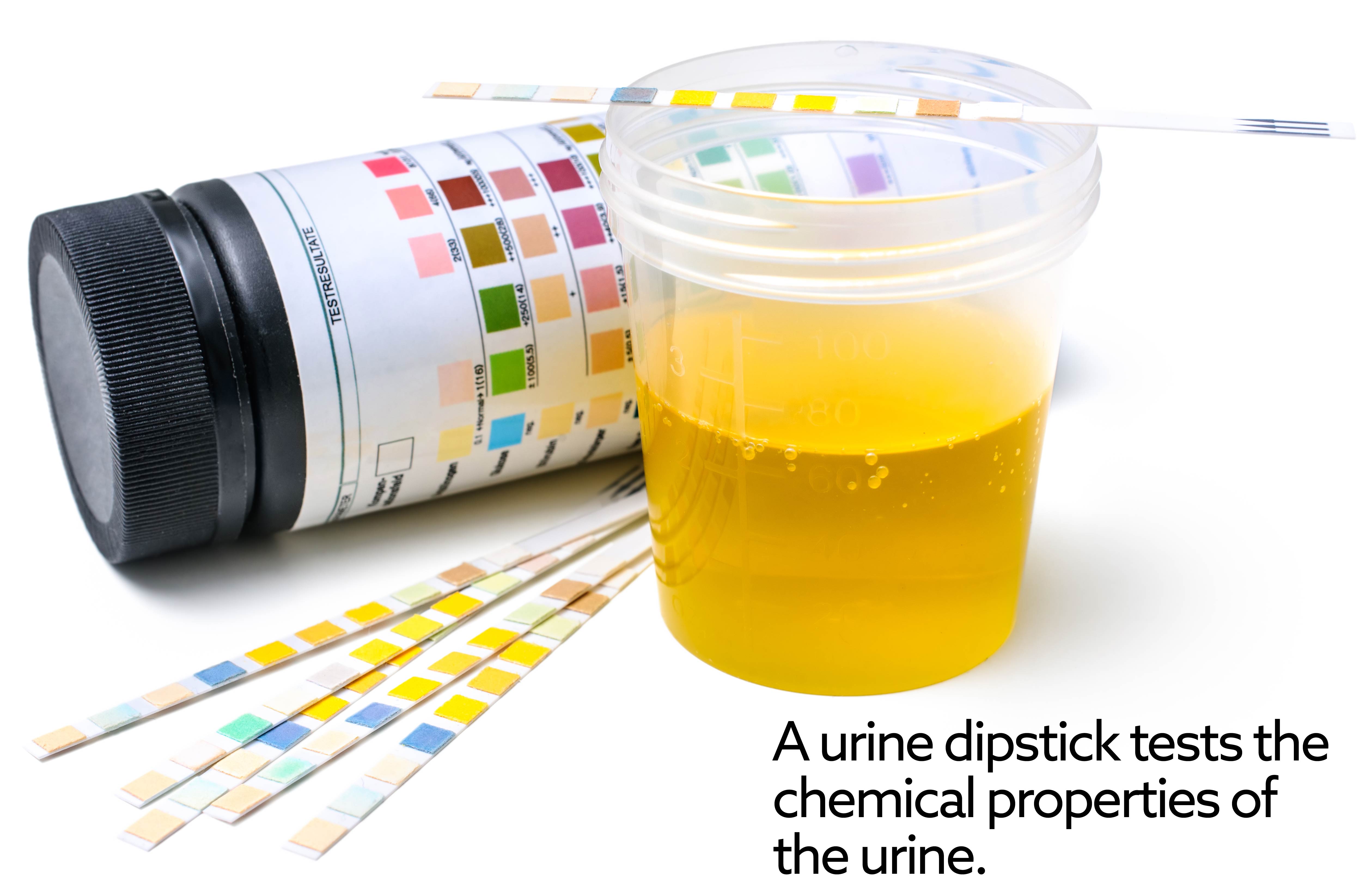 urine_dipstick_1