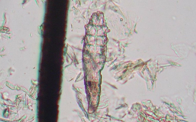 demodex_with_follcile