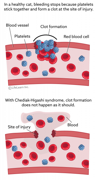 chediak_higashi_syndrome-01