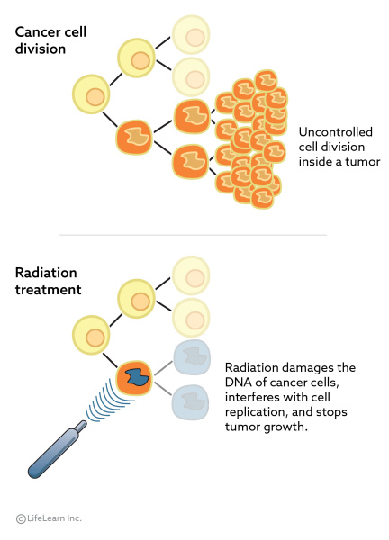 radiation_treatment_2018