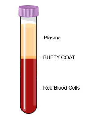 buffy_coat_examination-1