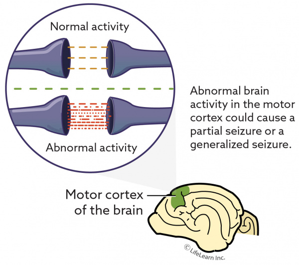 seizures_general_2018-01 seizures_general_2018-01