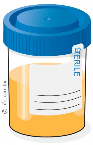 urine_jar_updated2017-01