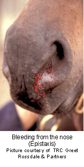 epistaxis-1