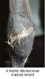 first_aid_wounds-1