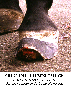 keratoma-1