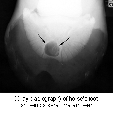 keratoma-2