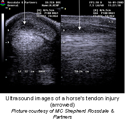 suspensory_ligament-1