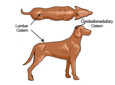 cerebrospinal_fluid_collection_and_examination-2