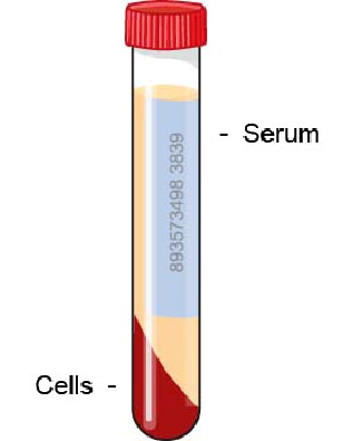 serum_protein_electrophoresis-1 serum_protein_electrophoresis-1
