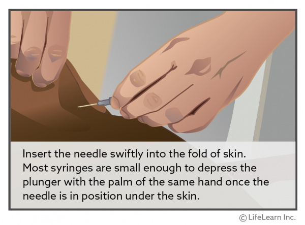 Cat owner is inserting the needle swiftly into the fold of skin. Most syringes are small enough to depress the plunger with the palm of the same hand once the needle is in position under the skin.