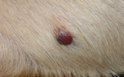 vascular_tumor_skin