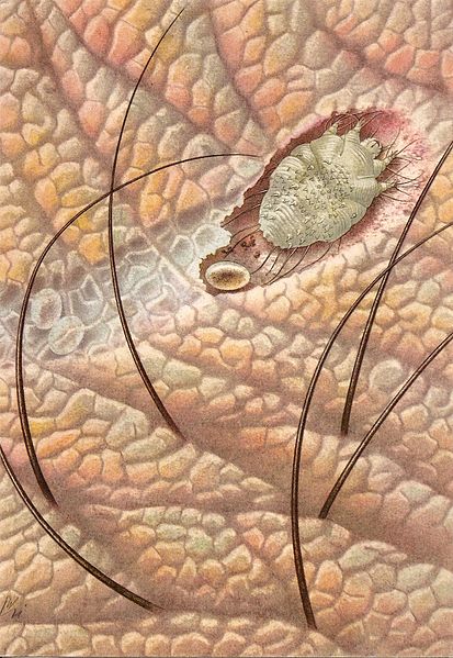 sarcoptes_scabiei__sarcoptic_mange sarcoptes_scabiei__sarcoptic_mange