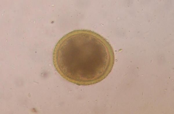 toxocara_canis_roundworm_egg_2 toxocara_canis_roundworm_egg_2